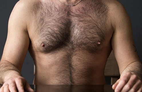 مصرف مکمل های تقویت کننده مو تاثیری در افزایش موهای زائد بدن دارد؟